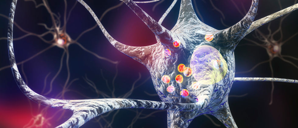 Investigadores associam alteração de gene a doença de Parkinson 